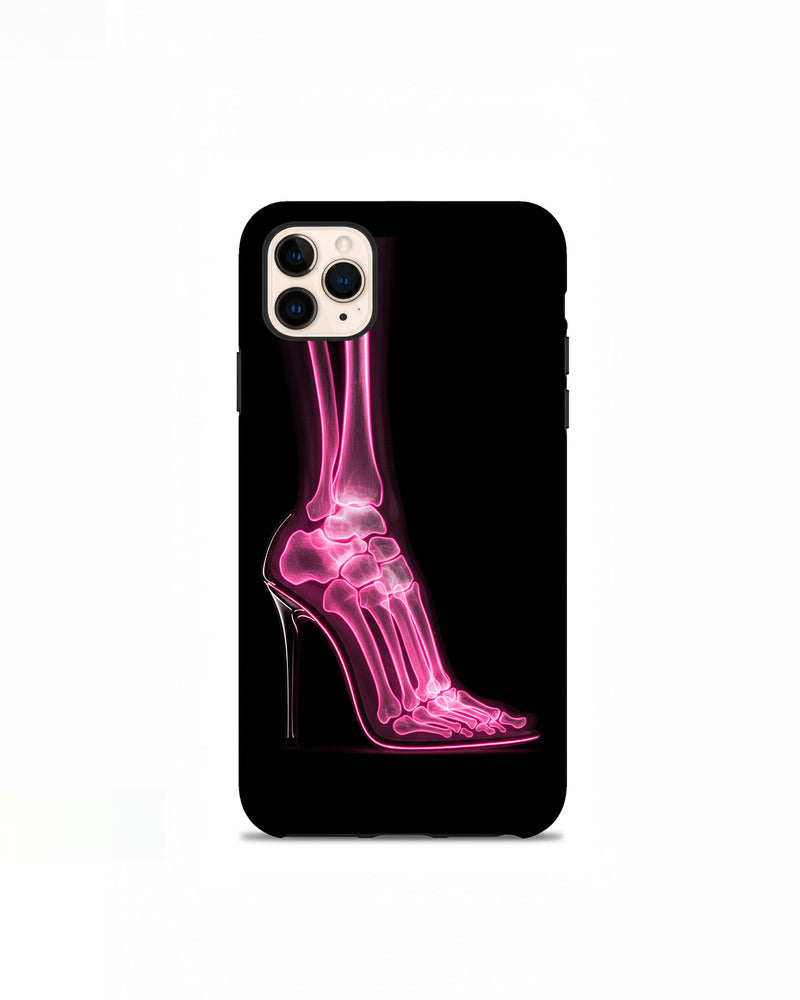 Eliana Skeleton Heels Phone Case - Black/Pink